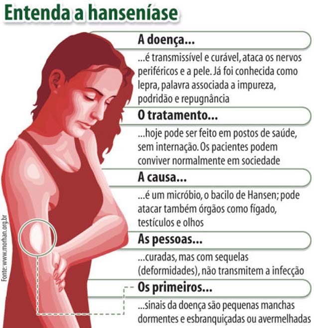 Sonhar com vermes