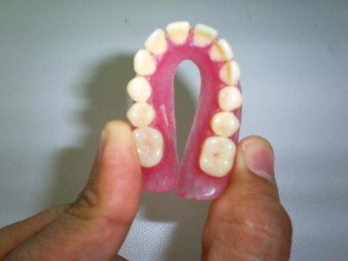 Fotos de protese silicone Fotos de protese silicone