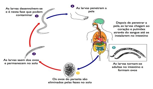 Ascaridíase Lombriga Sintomas Tratamento Transmissão